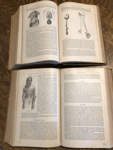Antique Medical Books, System Of Surgery Gross Vol 1&2 1872 -Orig Leather W/ Adv