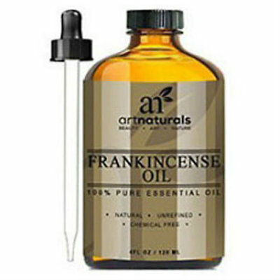 Art Naturals 4-ounce Frankincense Essential Oil Sooth Minor Cuts Burns Sleep Aid