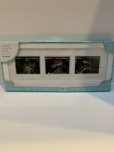 Ultrasound Picture Frame Keepsake Sonogram Photo Image Fetus Baby Trimester Scan