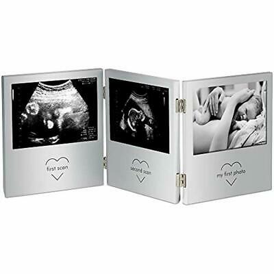 Triple Keepsake Frames Sonogram Picture For Ultrasound Pregnancy Scan Images And