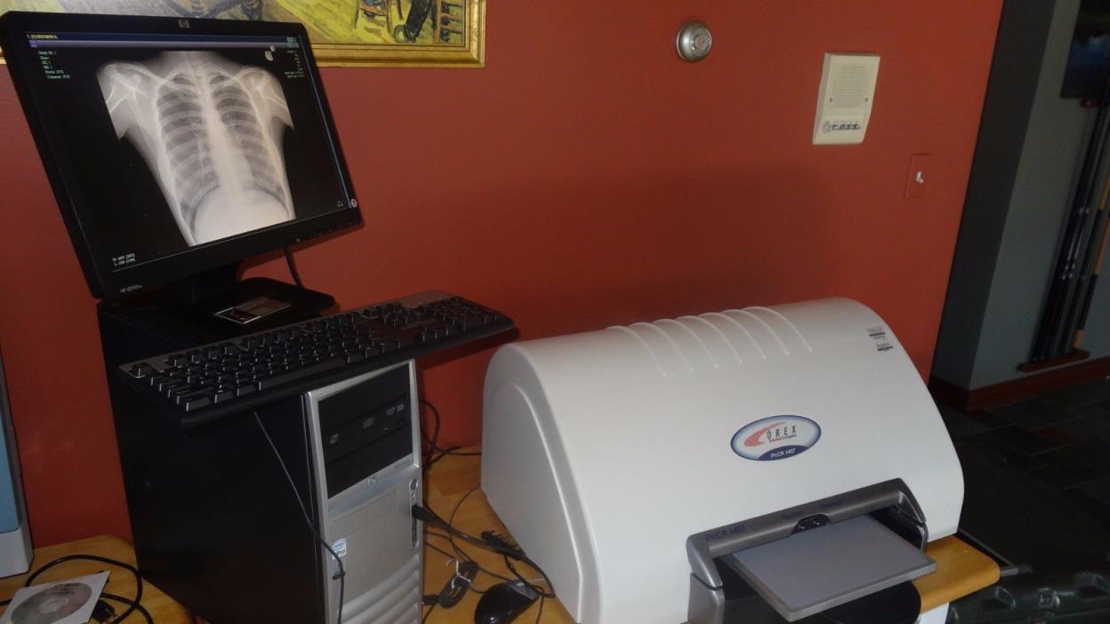 chiropractic digital xray cr reader with warranty, nucca software x-ray