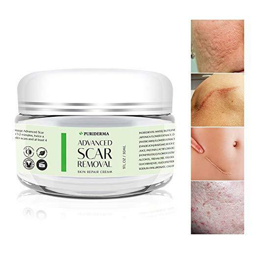 Scar Removal Cream - Advanced Treatment for Face & Body Old & New Scars from Cut