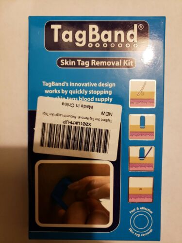 TagBand Skin Tag Removal Kit, Fast & Effective for Medium to Large Skin Tags