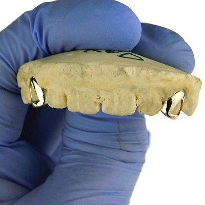 Custom Fitted Single Cap Grillz Set Open Face 925 Gold Plated Two Canine Teeth